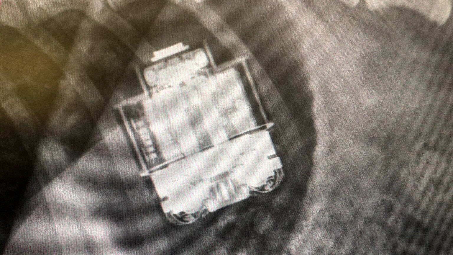 AirPods in dog's stomach